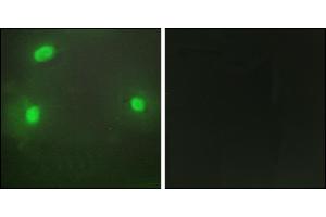 Immunofluorescence analysis of HeLa cells, using FEN1 antibody.