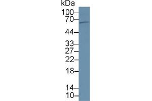 Detection of PCSK9 in Rat Liver lysate using Polyclonal Antibody to Proprotein Convertase Subtilisin/Kexin Type 9 (PCSK9) (PCSK9 antibody  (AA 164-428))