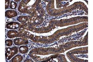 IHC-P Image ARL14 antibody [N1C3] detects ARL14 protein at cytoplasm and membrane in mouse duodenum by immunohistochemical analysis. (ARL14 antibody  (full length))