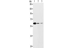 Western Blotting (WB) image for anti-ATP-Binding Cassette, Sub-Family E (OABP), Member 1 (ABCE1) antibody (ABIN2422371)