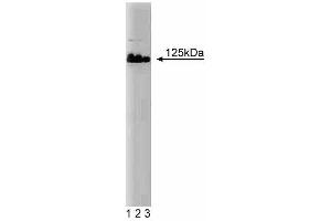 Western blot analysis of DNA Polymerase delta on Jurkat lysate. (POLD1 antibody  (AA 60-261))