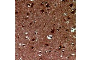 Immunohistochemical analysis of EID1 staining in human brain formalin fixed paraffin embedded tissue section. (EID1 antibody)