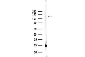 anti-MN1 proto-oncogene (MN1) (Internal Region) antibody