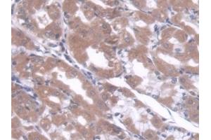 Detection of CBFb in Human Stomach Tissue using Polyclonal Antibody to Core Binding Factor Beta Subunit (CBFb) (CBFB antibody  (AA 1-182))