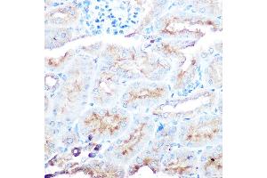 Immunohistochemistry of paraffin-embedded human liver using ZIP14 Rabbit pAb (ABIN6133191, ABIN6147993, ABIN6147994 and ABIN6214658) at dilution of 1:50 (40x lens). (SLC39A14 antibody  (AA 240-340))