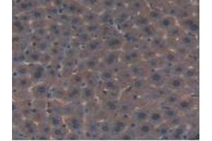 IHC-P analysis of Mouse Liver Tissue, with DAB staining. (FLT4 antibody  (AA 30-326))