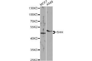 Western blot analysis of extracts of various cell lines, using SHH antibody (ABIN5975790) at 1/1000 dilution. (Sonic Hedgehog antibody)