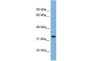 WB Suggested Anti-PEX11A  Antibody Titration: 0. (PEX11A antibody  (N-Term))