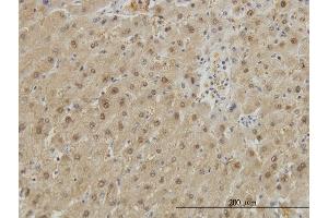 Immunoperoxidase of monoclonal antibody to GSTA1 on formalin-fixed paraffin-embedded human liver. (GSTA1 antibody  (AA 1-222))