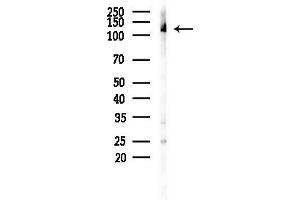 anti-EPH Receptor B2 (EPHB2) (C-Term) antibody