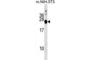 Western Blotting (WB) image for anti-DnaJ (Hsp40) Homolog, Subfamily C, Member 5 (DNAJC5) antibody (ABIN2999623)