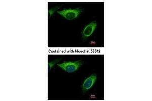 ICC/IF Image Immunofluorescence analysis of methanol-fixed HeLa, using MEK2, antibody at 1:500 dilution. (MEK2 antibody)