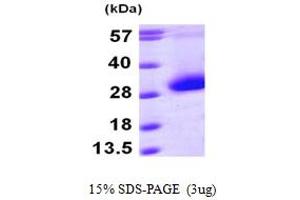 SDS-PAGE (SDS) image for Cyclin-Dependent Kinase Inhibitor 3 (CDKN3) (AA 1-212) protein (His tag) (ABIN667848) (CDKN3 Protein (AA 1-212) (His tag))