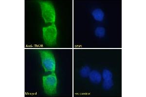 Immunofluorescence (IF) image for anti-Integral Membrane Protein 2B (ITM2B) (Internal Region) antibody (ABIN570955)