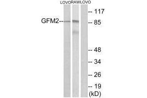 Western blot analysis of extracts from LOVO cells and RAW264. (GFM2 antibody)