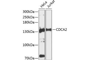 Western blot analysis of extracts of various cell lines, using CDC antibody (ABIN6131118, ABIN6138269, ABIN6138270 and ABIN6224963) at 1:3000 dilution. (CDCA2 antibody  (AA 724-1023))