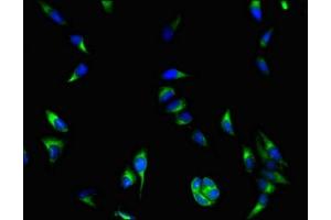 Immunofluorescent analysis of Hela cells using ABIN7145558 at dilution of 1:100 and Alexa Fluor 488-congugated AffiniPure Goat Anti-Rabbit IgG(H+L) (COASY antibody  (AA 453-546))