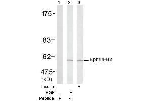 Image no. 1 for anti-Ephrin B2 (EFNB2) (Tyr316) antibody (ABIN197416) (Ephrin B2 antibody  (Tyr316))