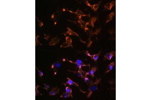 Immunofluorescence analysis of U-251 MG cells using AMPH Rabbit pAb (ABIN6127430, ABIN6136846, ABIN6136847 and ABIN6221037) at dilution of 1:100 (40x lens). (Amphiphysin antibody  (AA 340-620))