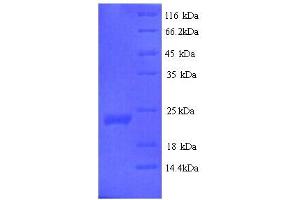 SDS-PAGE (SDS) image for Vascular Endothelial Growth Factor B (VEGFB) (AA 22-207) protein (His tag) (ABIN5713938) (VEGFB Protein (AA 22-207) (His tag))