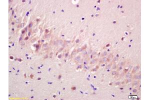 Formalin-fixed and paraffin embedded rat brain labeled with Anti-phospho-GSK3 Alpha(Ser21) Polyclonal Antibody, Unconjugated (ABIN708116) at 1:200 followed by conjugation to the secondary antibody and DAB staining (GSK3 alpha antibody  (pSer21))