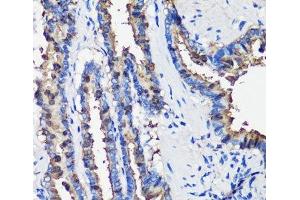 Immunohistochemistry of paraffin-embedded Rat lung using SCGB1A1 Polyclonal Antibody at dilution of 1:100 (40x lens). (SCGB1A1 antibody)