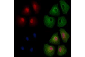 CBX4 Antibody staining A549 cells by IF/ICC.
