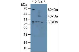 Figure. (Proteasome 26S Subunit, Non ATPase 9 (AA 2-223) antibody)