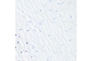 Immunohistochemistry of paraffin-embedded Human normal uterus (negative control sample) using MUC1 Rabbit mAb (ABIN7268687) at dilution of 1:100 (40x lens). (MUC1 antibody)