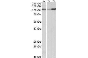 ABIN1686784 (0. (ATP2A2 antibody  (Internal Region))