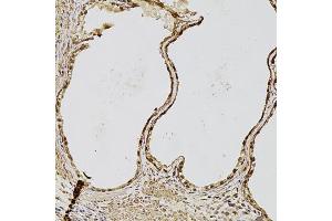 Immunohistochemistry of paraffin-embedded human prostate using FGF2 antibody (ABIN1872685) at dilution of 1:100 (20x lens). (FGF2 antibody)