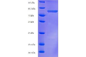SDS-PAGE (SDS) image for Plasminogen Activator Inhibitor 1 (SERPINE1) (AA 23-402) protein (His-SUMO Tag) (ABIN5710342) (PAI1 Protein (AA 23-402) (His-SUMO Tag))