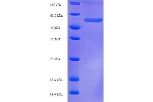 SDS-PAGE (SDS) image for Plasminogen Activator Inhibitor 1 (SERPINE1) (AA 23-402) protein (His-SUMO Tag) (ABIN5710342)