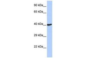 Image no. 1 for anti-Ring Finger Protein 113B (RNF113B) (AA 108-157) antibody (ABIN6740404) (RNF113B antibody  (AA 108-157))