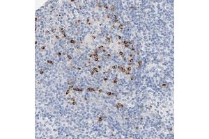 Immunohistochemical staining of human lymph node with GZMB polyclonal antibody  shows strong cytoplasmic positivity in a subset of lymphoid cells outside reaction center at 1:50-1:200 dilution.