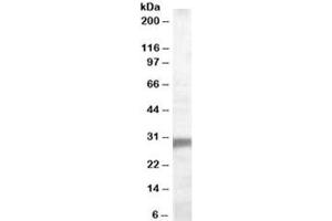 Western blot testing of human muscle lysate with EGLN3 antibody at 0.