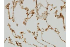 Image no. 4 for anti-SH2 Domain Containing 4A (SH2D4A) (AA 239-338) antibody (ABIN599292) (SH2D4A antibody  (AA 239-338))