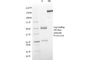 SDS-PAGE Analysis Purified GAD1 (GAD67) Mouse Monoclonal Antibody (GAD1/2563). (GAD antibody  (AA 72-135))