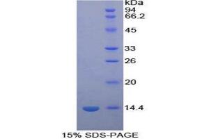 SDS-PAGE (SDS) image for Platelet Factor 4 (PF4) (AA 31-101) protein (His tag) (ABIN1080543)
