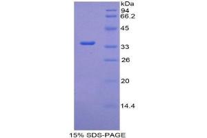 SDS-PAGE (SDS) image for Coagulation Factor V (F5) (AA 1908-2203) protein (His tag) (ABIN2120831) (Coagulation Factor V Protein (F5) (AA 1908-2203) (His tag))