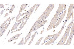 Detection of PDL1 in Rat Cardiac Muscle Tissue using Monoclonal Antibody to Programmed Cell Death Protein 1 Ligand 1 (PDL1) (PD-L1 antibody  (AA 34-241))