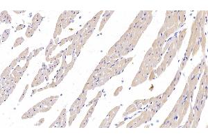 Detection of PDL1 in Rat Cardiac Muscle Tissue using Monoclonal Antibody to Programmed Cell Death Protein 1 Ligand 1 (PDL1) (PD-L1 antibody  (AA 34-241))