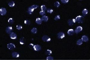 Immunofluorescent staining of Jurkat cells. (BCL2L1 antibody  (AA 18-233))