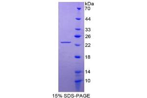SDS-PAGE (SDS) image for Fibroblast Growth Factor 10 (FGF10) (AA 38-208) protein (His tag) (ABIN1981018) (FGF10 Protein (AA 38-208) (His tag))