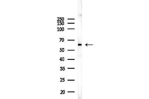 Western blot analysis of lysates from Mouse liver, using CC Antibody at 1/1000 dilution.