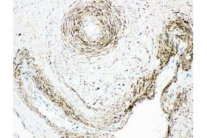 Anti-Monoamine Oxidase A antibody, IHC(P) IHC(P): Human Placenta Tissue (Monoamine Oxidase A antibody  (N-Term))