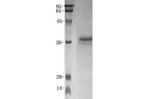 Validation with Western Blot (CRISP3 Protein (Transcript Variant 2) (His tag))