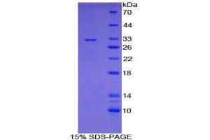 SDS-PAGE analysis of Mouse CYP7A1 Protein. (CYP7A1 Protein)
