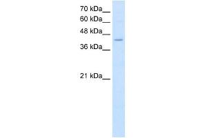 FADS1 antibody used at 2. (FADS1 antibody  (C-Term))