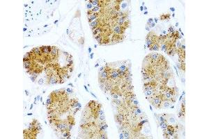 Immunohistochemistry of paraffin-embedded Human stomach using C8orf4 Polyclonal Antibody at dilution of 1:100 (40x lens). (C8orf4 antibody)